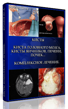 5-1024x1024.png