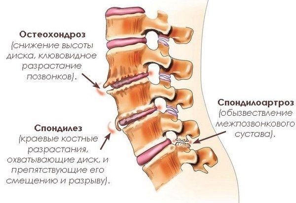 i12.pixs.ru_storage_6_9_8_1jpg_6020001_23690698.jpg